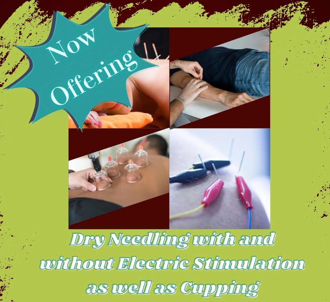 Chiropractic Copperas Cove TX Dry Needling & Cupping